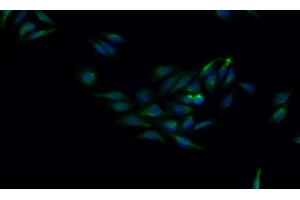 Detection of CTSK in Human HepG2 cell using Monoclonal Antibody to Cathepsin K (CTSK) (Cathepsin K anticorps  (AA 115-329))