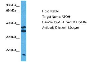 Host:  Rabbit  Target Name:  ATOH1  Sample Tissue:  Human Jurkat Whole Cell  Antibody Dilution:  1ug/ml (ATOH1 anticorps  (Middle Region))
