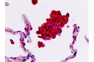 Anti-SELL / L-Selectin / CD62L antibody IHC staining of human lung, macrophages.