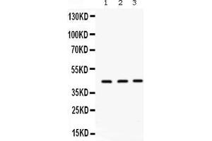 Western blot analysis of ORM1 expression in rat liver extract ( Lane 1), mouse liver extract ( Lane 2) and PANC whole cell lysates ( Lane 3). (ORM1 anticorps  (AA 19-201))