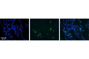 Rabbit Anti-RNASET2 Antibody     Formalin Fixed Paraffin Embedded Tissue: Human Lung Tissue  Observed Staining: Cytoplasmic in in alveolar cells, type I and II  Primary Antibody Concentration: 1:100  Other Working Concentrations: 1/600  Secondary Antibody: Donkey anti-Rabbit-Cy3  Secondary Antibody Concentration: 1:200  Magnification: 20X  Exposure Time: 0. (RNASET2 anticorps  (Middle Region))