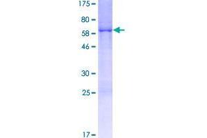 Image no. 1 for Coiled-Coil Domain Containing 106 (CCDC106) (AA 1-280) protein (GST tag) (ABIN1348240)