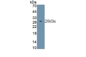 Detection of Recombinant ERK1, Human using Monoclonal Antibody to Extracellular Signal Regulated Kinase 1 (ERK1) (ERK1 anticorps  (AA 75-312))