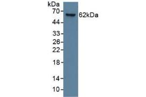 Mouse Capture antibody from the kit in WB with Positive Control: Human lung lysate.