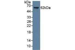 Mouse Capture antibody from the kit in WB with Positive Control: Human lung lysate. (KRT9 Kit ELISA)