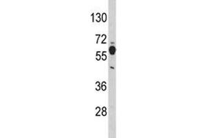 Western blot analysis of PHGDH antibody and mouse brain tissue lysate.