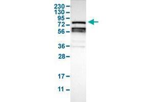Western Blot analysis of human cell line RT-4 with RIPK1 polyclonal antibody . (RIPK1 anticorps  (AA 306-449))