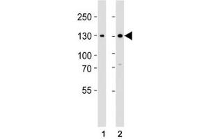 Western blot analysis of lysate from (1) 293 and (2) Jurkat cell line using GLI2 antibody at 1:1000.