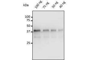Anti-Pepsin Ab at 1/500 dilution, 40-100 ng of Pepsin isolated from porcine gastric mucosa, rabbit polyclonal to goat lgG (HRP) at 1/10,000 dilution,