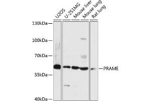 Western blot analysis of extracts of various cell lines, using PRAME antibody (ABIN7269507) at 1:3000 dilution. (PRAME anticorps  (AA 1-200))