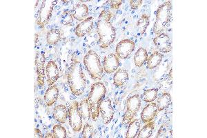Immunohistochemistry of paraffin-embedded rat kidney using CD64 Rabbit pAb (ABIN3021694, ABIN3021695, ABIN3021696 and ABIN6215530) at dilution of 1:100 (40x lens).