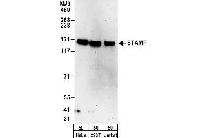anti-Tubulin tyrosine Ligase-Like Family, Member 5 (TTLL5) (AA 1231-1281) antibody