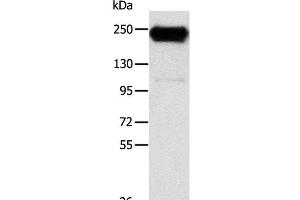 Western Blot analysis of K562 cell using RRBP1 Polyclonal Antibody at dilution of 1:400 (RRBP1 anticorps)