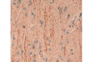Used in DAB staining on fromalin fixed paraffin- embedded brain tissue (CADPS anticorps  (AA 1186-1352))