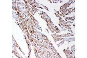 Anti-MMP14 antibody, IHC(P) IHC(P): Rat Cardiac Muscle Tissue