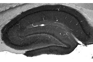 Adult rat hippocampus immunohistochemistry. (WASF1 anticorps  (AA 477-498))