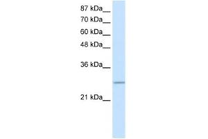 WB Suggested Anti-C20ORF20 Antibody Titration: 0. (MRGBP anticorps  (Middle Region))