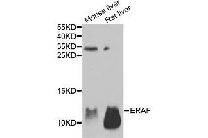 Western blot analysis of extracts of various cell lines, using AHSP antibody. (aHSP anticorps)