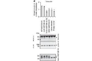 MEF2B mutations alter the abundance of protein from MEF2B target genes and decrease cell migration. (Vimentin anticorps)