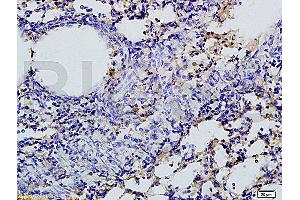 Formalin-fixed and paraffin embedded rat lung tissue labeled with Rabbit Anti-SGLT1 Polyclonal Antibody, Unconjugated (ABIN738066) 1:200 followed by conjugation to the secondary antibody and DAB staining (SLC5A1 anticorps  (AA 401-500))