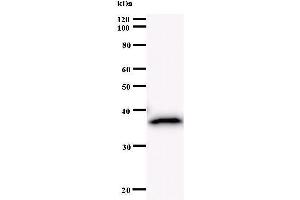 Western Blotting (WB) image for anti-BRCA1 Associated RING Domain 1 (BARD1) antibody (ABIN930988) (BARD1 anticorps)