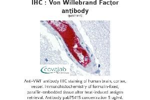 Image no. 1 for anti-Von Willebrand Factor (VWF) antibody (ABIN1740780) (VWF anticorps)