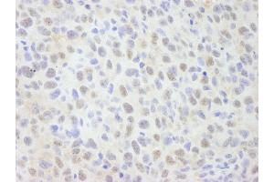 Immunohistochemistry (IHC) image for anti-SNW Domain Containing 1 (SNW1) (AA 450-500) antibody (ABIN7448684) (SNW1 anticorps  (AA 450-500))