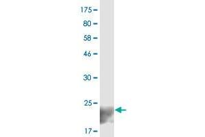 Western Blot detection against Immunogen (20.