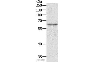 Western blot analysis of Jurkat cell, using TRAF3IP2 Polyclonal Antibody at dilution of 1:500 (TRAF3IP2 anticorps)