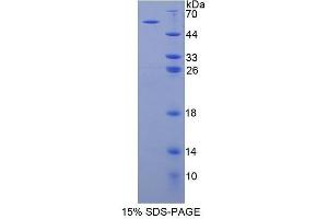 SDS-PAGE (SDS) image for Myosin IC (MYO1C) (AA 765-1011) protein (His tag,GST tag) (ABIN3209941) (Myosin IC Protein (MYO1C) (AA 765-1011) (His tag,GST tag))