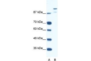 WB Suggested Anti-HKR1 Antibody Titration:  0. (HKR1 anticorps  (N-Term))
