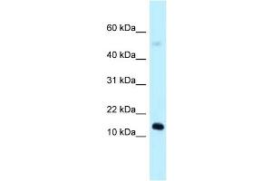 WB Suggested Anti-1110059E24Rik Antibody Titration: 1. (1110059E24Rik anticorps  (N-Term))