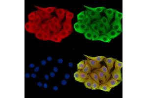 ABIN7095895 and ABIN7099957 staining Hela cells by IF/ICC. (RDH12 anticorps)