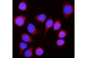 IF analysis of Nicastrin/NCSTN using anti-Nicastrin/NCSTN antibody (ABIN7601402). (Nicastrin anticorps  (AA 34-669))