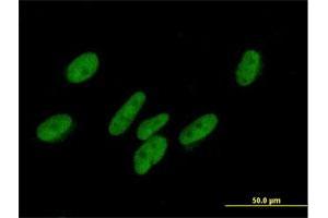 Immunofluorescence of purified MaxPab antibody to ZNF777 on HepG2 cell. (ZNF777 anticorps  (AA 1-518))