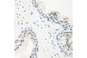 Immunohistochemistry of paraffin-embedded human prostate using PPAN antibody (ABIN6133157, ABIN6145994, ABIN6145996 and ABIN6223238) at dilution of 1:200 (40x lens). (PPAN anticorps  (AA 1-300))