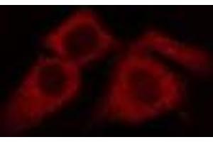 ABIN6275185 staining LOVO cells by IF/ICC. (HLA-H anticorps)