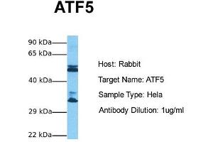 Host: Rabbit Target Name: ATF5 Sample Tissue: Human Hela Antibody Dilution: 1.