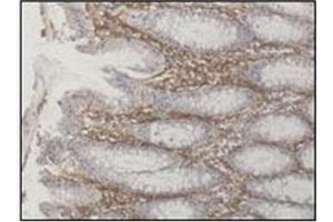 Paraformaldehyde-fixed paraffin-embedded biopsy from patient with confirmed colonic Crohn disease. (ATG16L1 anticorps  (AA 84-114))