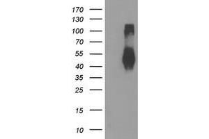 Western Blotting (WB) image for anti-Transmembrane Protein with EGF-Like and Two Follistatin-Like Domains 2 (TMEFF2) antibody (ABIN1501416) (TMEFF2 anticorps)