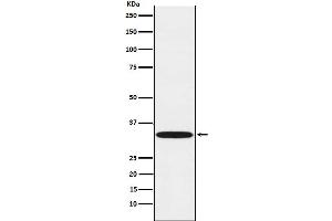 Western blot analysis of TREX1 expression in Daudi cell lysate.
