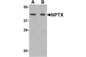 Western blot analysis of NPTX2 in mouse brain tissue lysate with NPTX2 antibody at (A) 0. (NPTX2 anticorps  (Center))