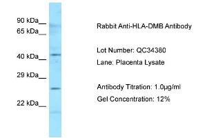 Host: Rabbit Target Name: HLA-DMB Sample Type: Human Placenta Antibody Dilution: 1.