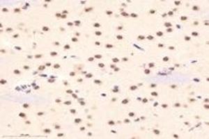 Immunohistochemistry analysis of paraffin-embedded mouse hippocampus using DAZAP1 (ABIN7073691) at dilution of 1: 6000