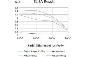 Black line: Control Antigen (100 ng),Purple line: Antigen (10 ng), Blue line: Antigen (50 ng), Red line:Antigen (100 ng)