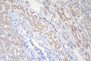 IHC analysis of TSC2 using anti-TSC2 antibody (ABIN7600203).