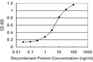 anti-Phenylalanine-tRNA Synthetase 2 (Mitochondrial) (FARS2) (AA 351-451) antibody