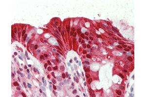 Anti-CA1 / Carbonic Anhydrase I antibody IHC staining of human colon.