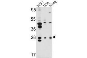 Image no. 1 for anti-E74-Like Factor 5 (Ets Domain Transcription Factor) (ELF5) (Middle Region) antibody (ABIN452951) (ELF5 anticorps  (Middle Region))