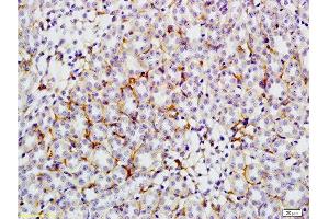 Formalin-fixed and paraffin embedded: rat kidney tissue labeled with Anti-GLUT4 Polyclonal Antibody , Unconjugated at 1:200, followed by conjugation to the secondary antibody and DAB staining